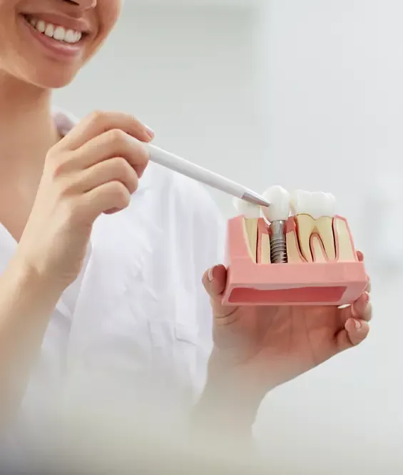 Model of dental implant